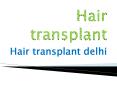 hair transplant delhi PowerPoint PPT Presentation