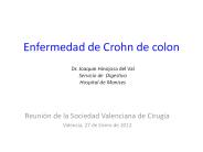 Enfermedad de Crohn de colon