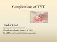 Complications of TVT PowerPoint PPT Presentation