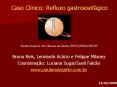 Caso Cl PowerPoint PPT Presentation