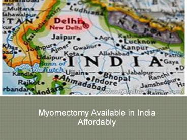Myomectomy Available in India Affordably