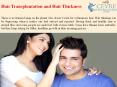 Hair Transplantation and Hair Thickness PowerPoint PPT Presentation