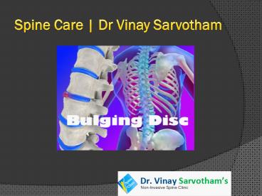 spine care by dr vinay sarvotham