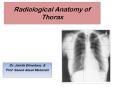 Radiological Anatomy of Thorax PowerPoint PPT Presentation