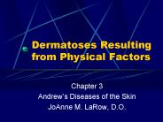 Dermatoses Resulting from Physical Factors