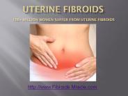 Uterine Fibroids