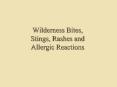 Wilderness Bites, Stings, Rashes and Allergic Reactions PowerPoint PPT Presentation