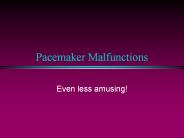 Pacemaker Malfunctions