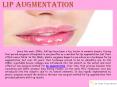 Lip Augmentation PowerPoint PPT Presentation