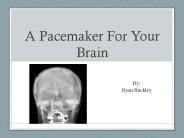A Pacemaker For Your Brain