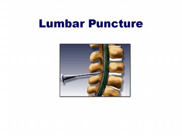 Lumbar Puncture