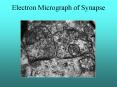 Electron Micrograph of Synapse PowerPoint PPT Presentation