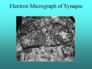 Electron Micrograph of Synapse