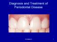 Diagnosis and Treatment of Periodontal Disease PowerPoint PPT Presentation