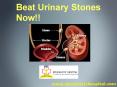 Urinary Stone Removal Kochi | Kidney Stone Treatment Kerala PowerPoint PPT Presentation