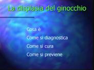 La displasia del ginocchio