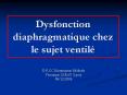 Dysfonction diaphragmatique chez le sujet ventil PowerPoint PPT Presentation