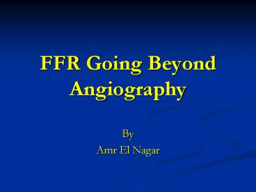 FFR Going Beyond Angiography