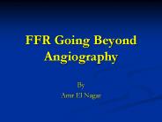 FFR Going Beyond Angiography
