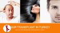 Top Hair Transplant in Turkey PowerPoint PPT Presentation