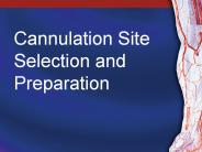 Cannulation Site Selection and Preparation