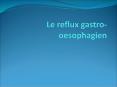 Le reflux gastro-oesophagien PowerPoint PPT Presentation