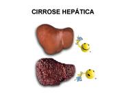 CIRROSE HEP