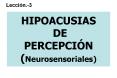 HIPOACUSIAS DE PERCEPCI PowerPoint PPT Presentation