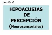 HIPOACUSIAS DE PERCEPCI