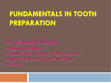 Fundamentals in Tooth Preparation