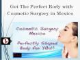 8 Places for Affordable Cosmetic Surgery in Mexico PowerPoint PPT Presentation