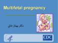 Multifetal pregnancy PowerPoint PPT Presentation