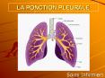 LA PONCTION PLEURALE PowerPoint PPT Presentation