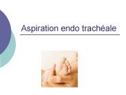 Aspiration endo trach