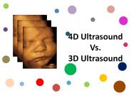 4D Ultrasound Vs. 3D Ultrasound