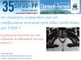 les avulsions suspect PowerPoint PPT Presentation