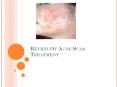 Review Of Acne Scar Treatment PowerPoint PPT Presentation