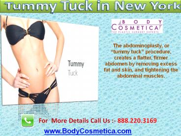 Tummy Tuck in New York
