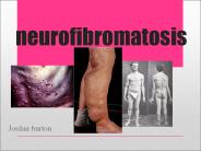 neurofibromatosis