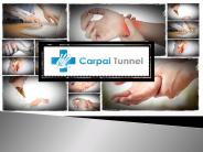 Carpal tunnel syndrome