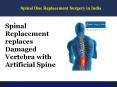 Spinal Disc Replacement Surgery in India PowerPoint PPT Presentation