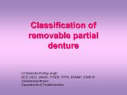 Classification of removable partial denture