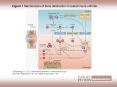 Figure 1 Mechanisms of bone destruction in autoimmune arthritis PowerPoint PPT Presentation