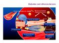 Diabetes and atherosclerosis PowerPoint PPT Presentation