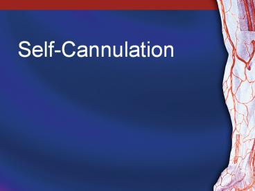 Self-Cannulation