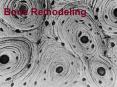 Bone Remodeling PowerPoint PPT Presentation