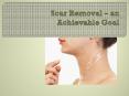Scar Removal – an Achievable Goal PowerPoint PPT Presentation