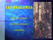 LES BRULURES