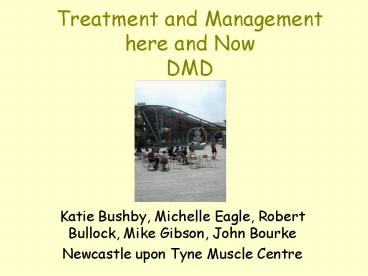 Treatment and Management here and Now DMD
