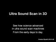 Ultra Sound Scan in 3D